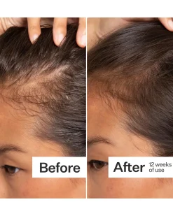 Act + Acre Scalp Serum